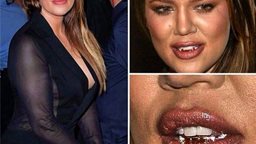 <b>2. </b>هكذا سخرت الفنانة احلام من اسنان كلوي كارديشيان الذهبية