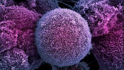 <b>3. </b>التاريخ المتوقع للقضاء على مرض السرطان