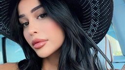رين خوري قبل وبعد عملية تجميل الأنف واسم الدكتور