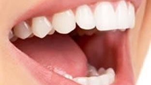 أبرز الطرق التي يمكنك اتباعها للتخلص من رائحة الفم الكريهة والمزعجة