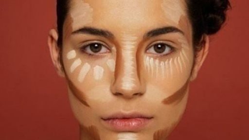 Before and after photos of Face Contouring