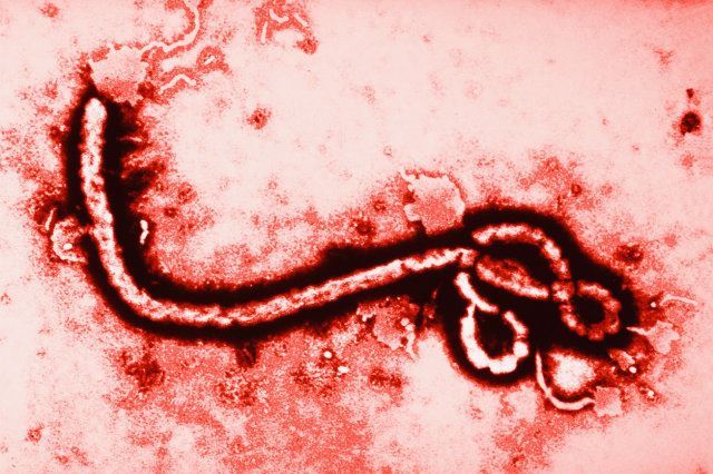 ايبولا ... وباء جديد خرج من افريقيا ويهدد العالم