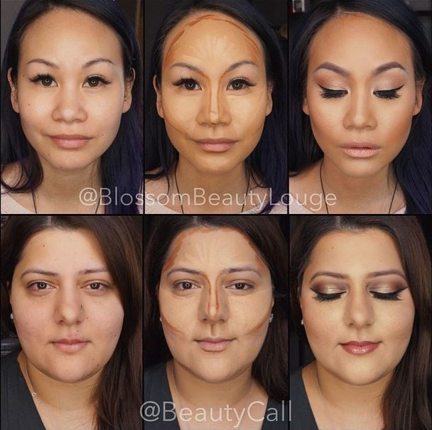 Before and after photos of Face Contouring