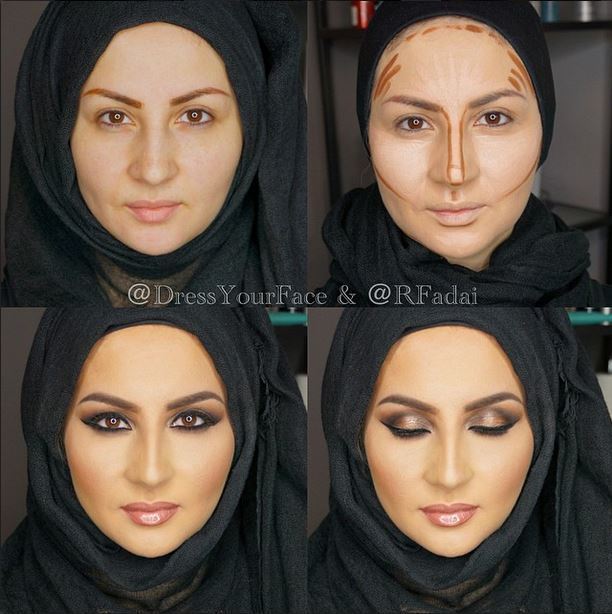 Before and after photos of Face Contouring
