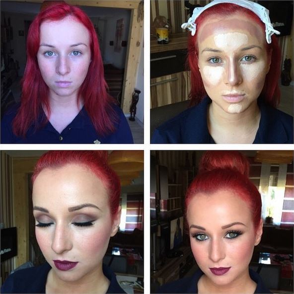 Before and after photos of Face Contouring