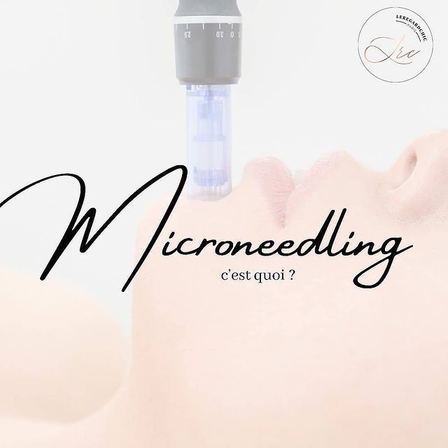 ما هي المشاكل التي يعالجها تقطيع الألياف Microneedling؟